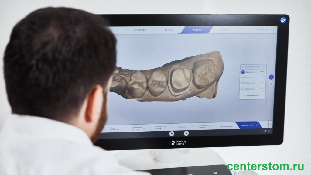 CEREC 3D решает задачи "зуб за час", что очень комфортно для пациента