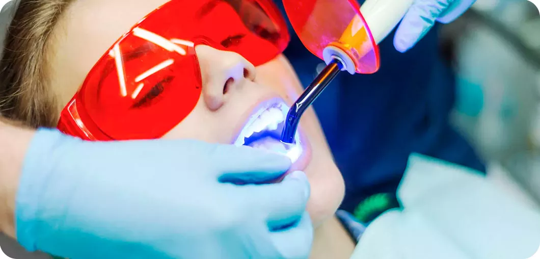 наращивание зубов этапы