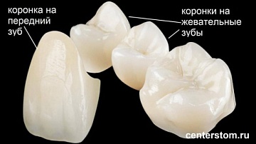 Коронки на зубы: передовые методики
