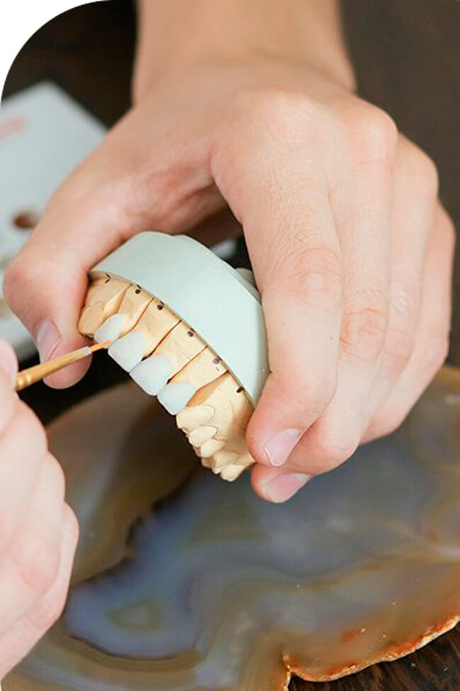 Изготовление протезов на зубы