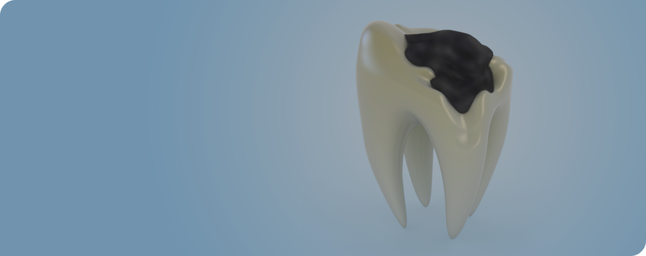 Восстановление зубов: виды и методы