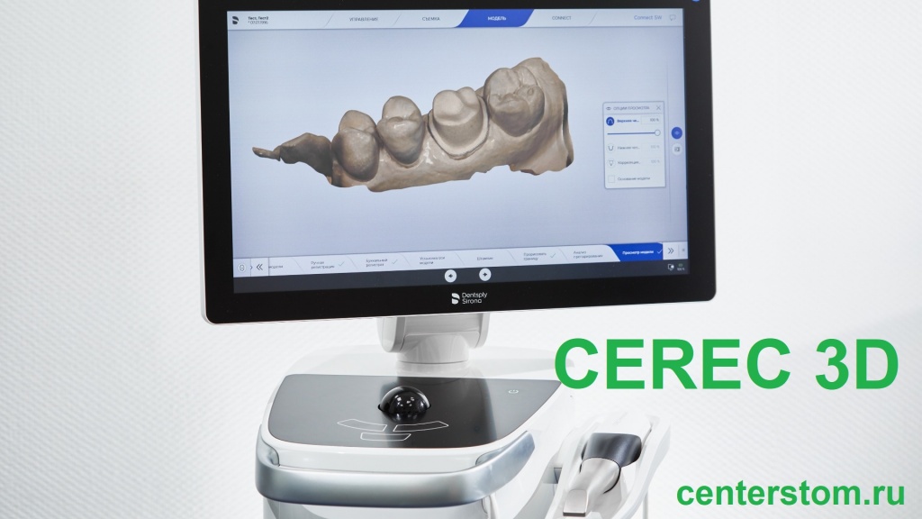Наш новый CEREC 3D – самая современная CAD/CAM технология
