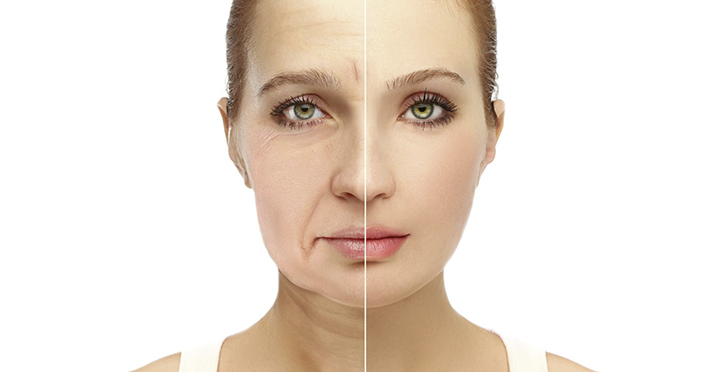Результаты коррекции асимметрии лица: до и после
