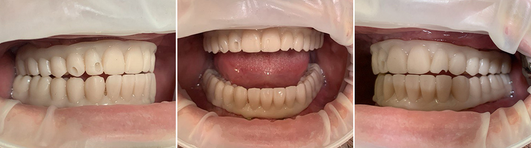 Приточка по буграм