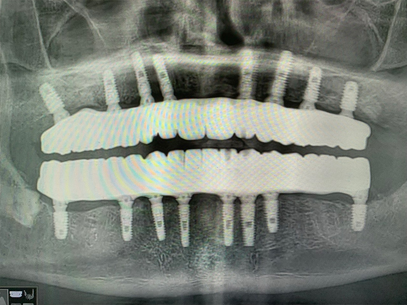 Панорамный снимок