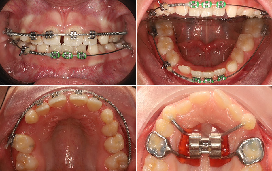 Процесс лечения