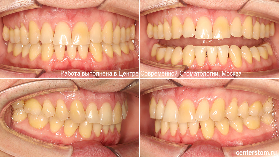Красивые ровные зубы и здоровые десна Красивые ровные зубы и здоровые десна