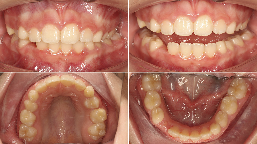 Ровные красивые зубы