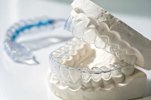 Изготовление и установка первых элайнеров