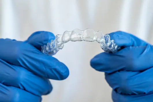 Изготовление и установка первых элайнеров