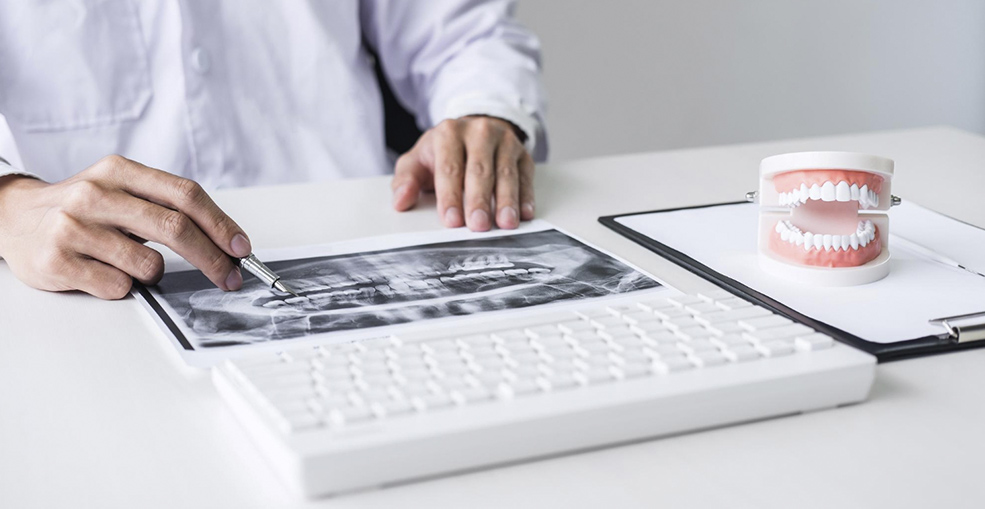 Диагностика перед имплантацией: КТ снимок челюсти