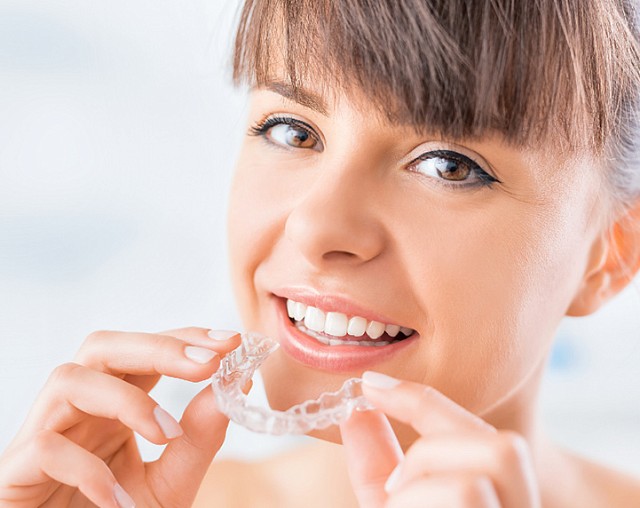 Элайнеры Angel Aligner в Москве — премиальное выравнивание зубов без брекетов
