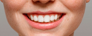 Как отбелить зубы: вред и польза домашнего отбеливания 