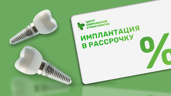 Имплантация в рассрочку