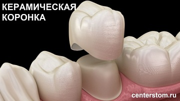 Керамическая коронка – быстрый способ восстановления зуба