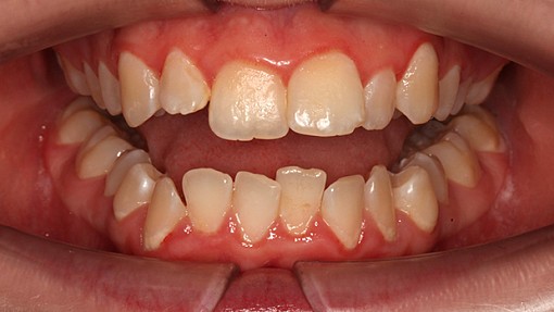 Командная работа: ортодонт и гнатолог на страже здоровья все полости рта